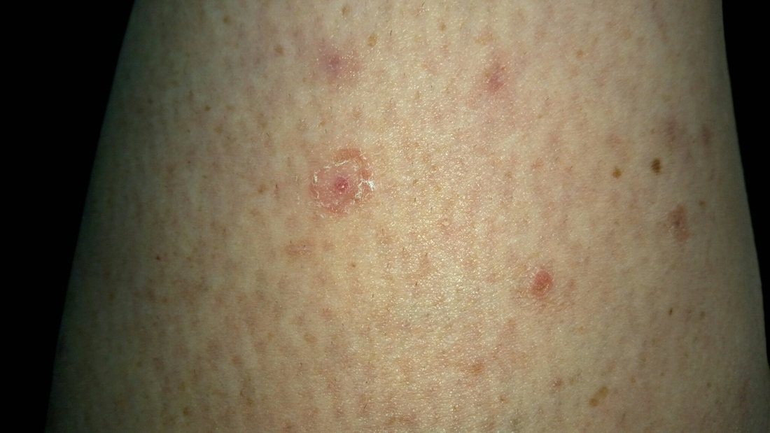new pinpoint red dots on skin